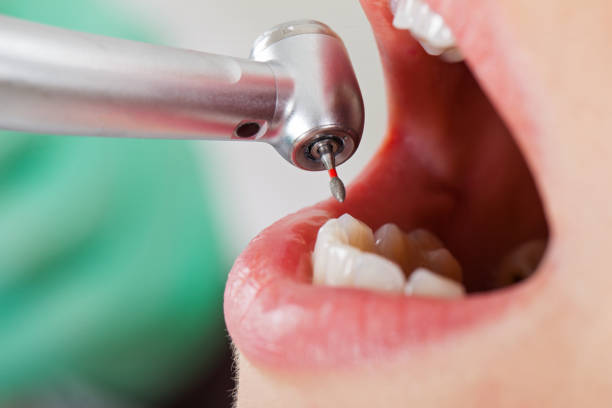 Best Cosmetic Emergency Dentistry in Midland City, AL